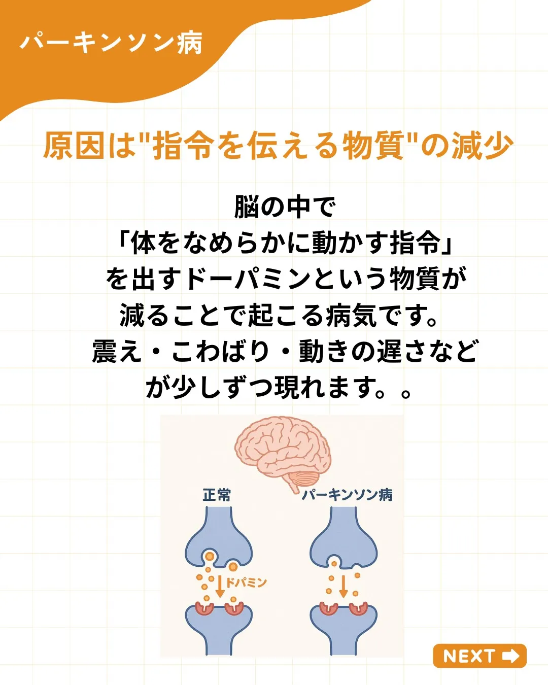 パーキンソン病って、どんな病気?🤔