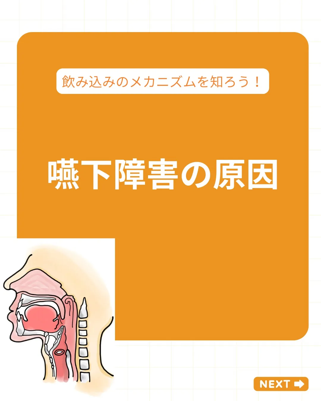 【嚥下障害の原因を整理する】