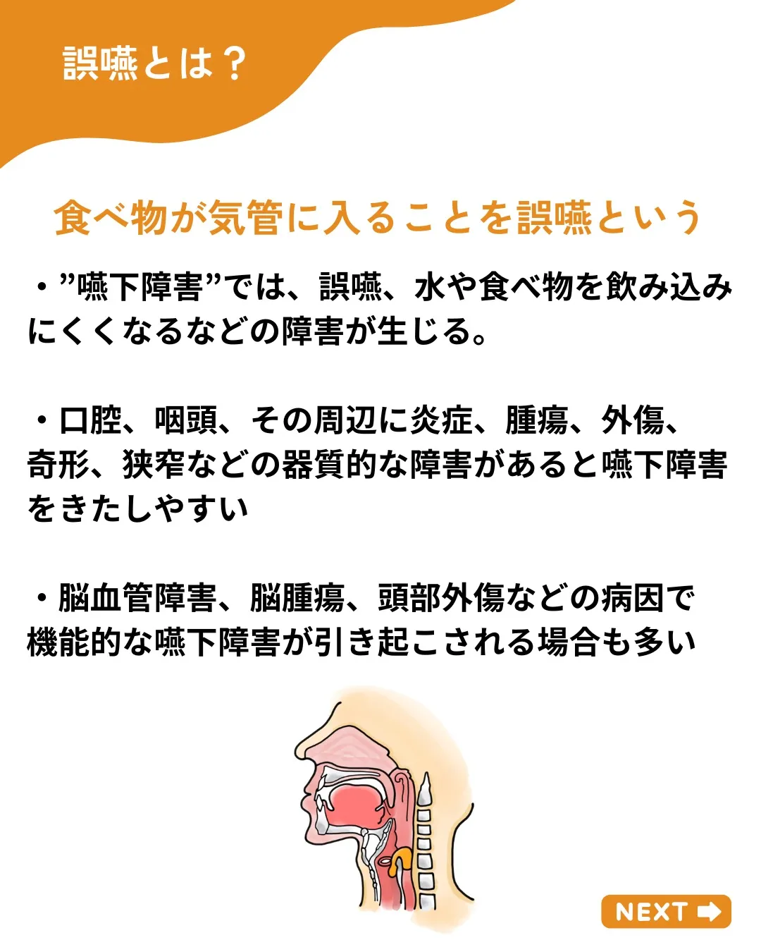 【嚥下障害の原因を整理する】
