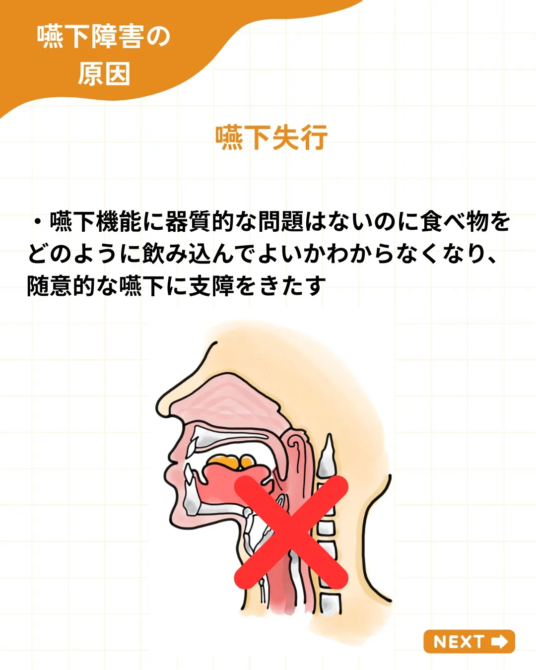 【嚥下障害の原因を整理する】