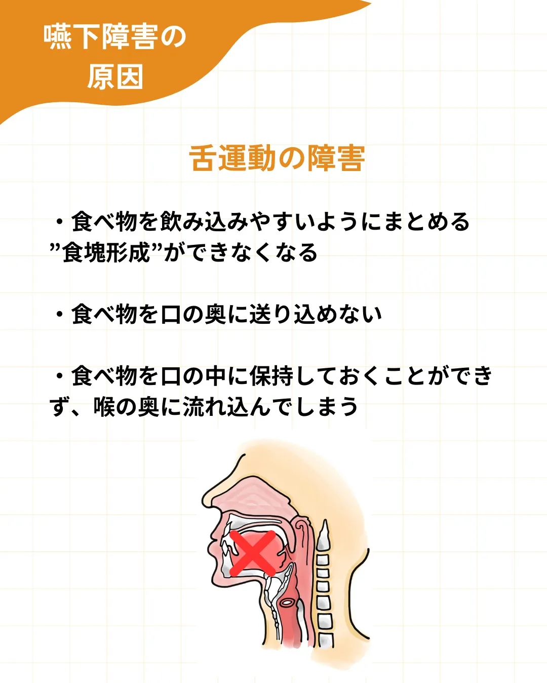 【嚥下障害の原因を整理する】