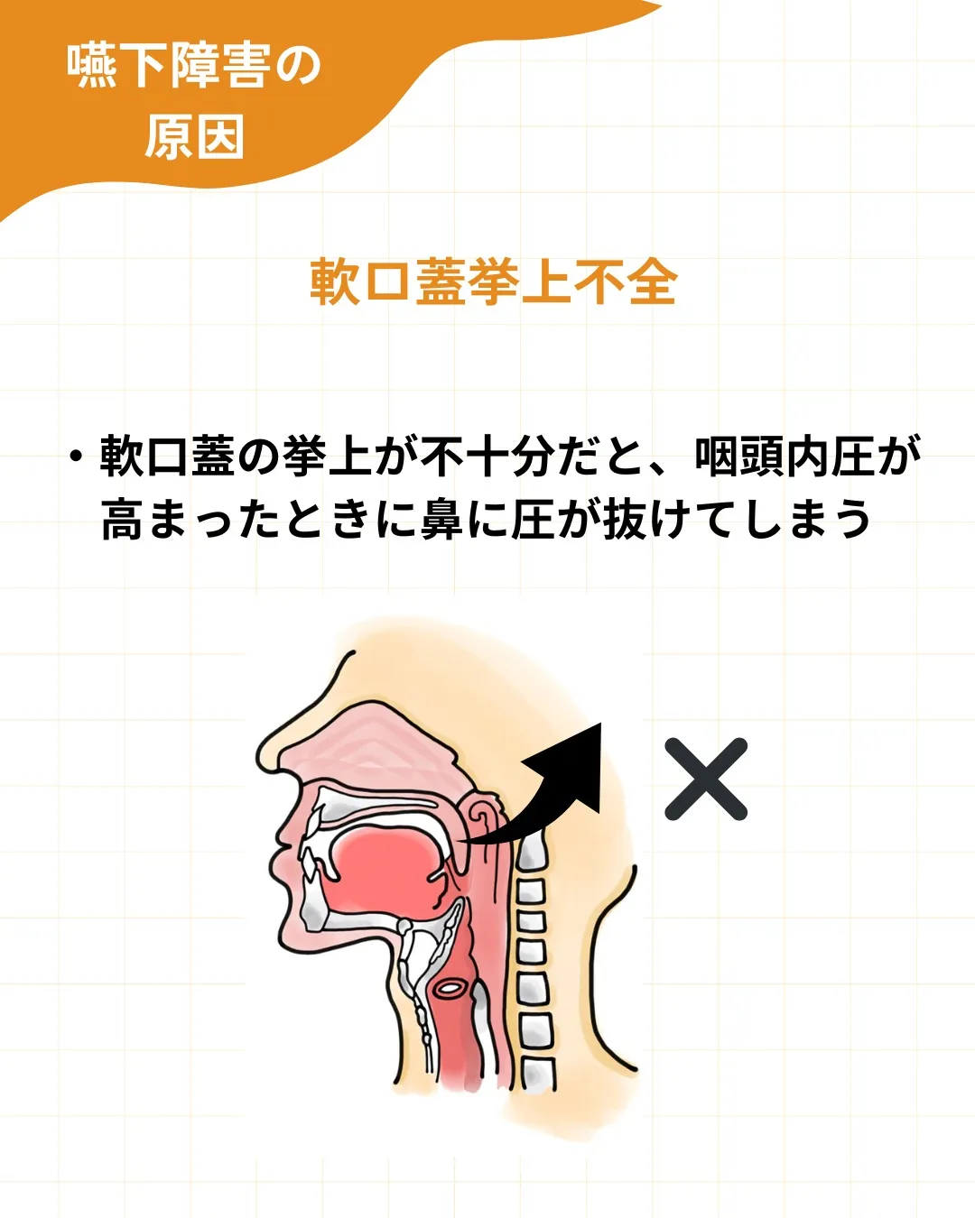 【嚥下障害の原因を整理する】