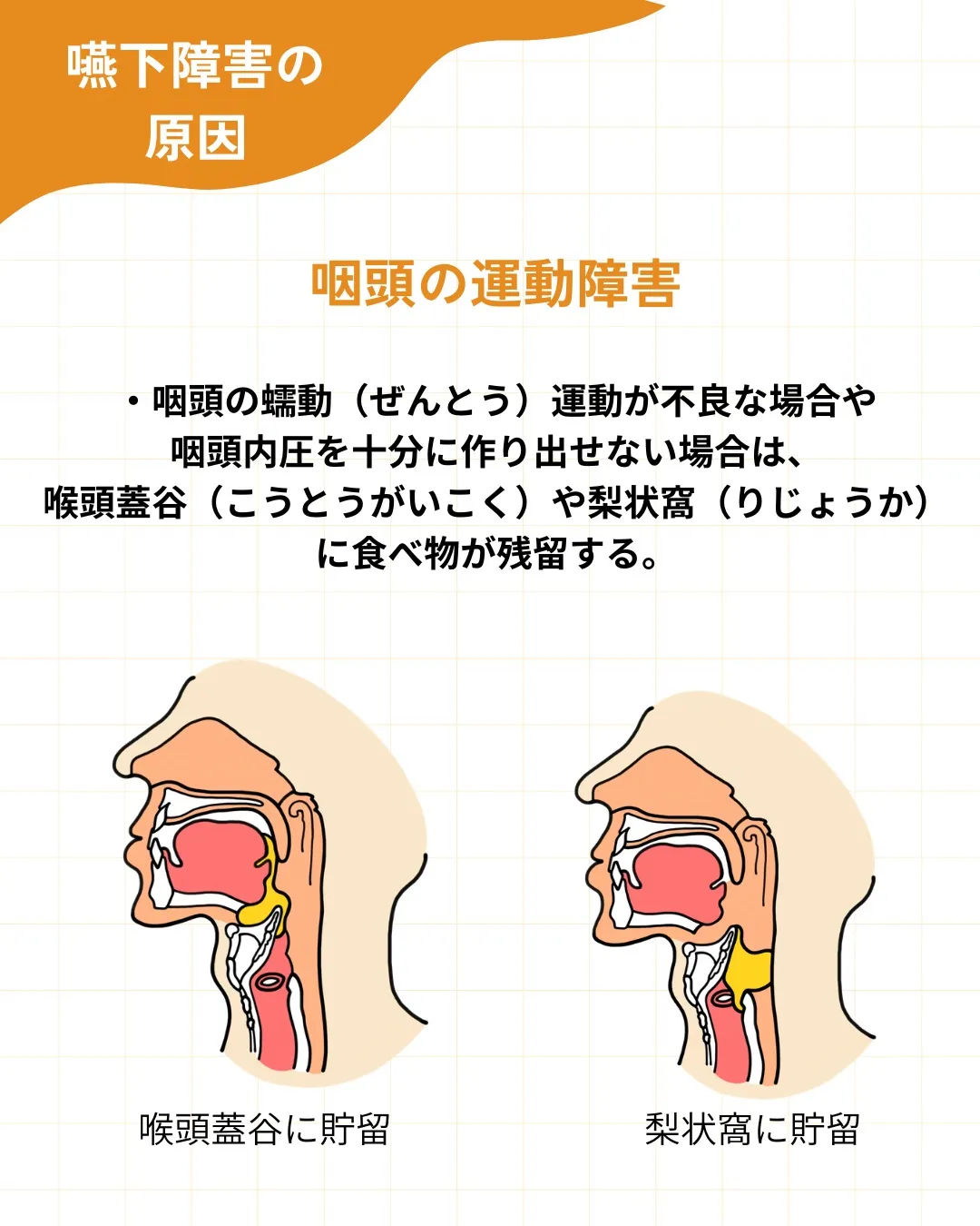 【嚥下障害の原因を整理する】